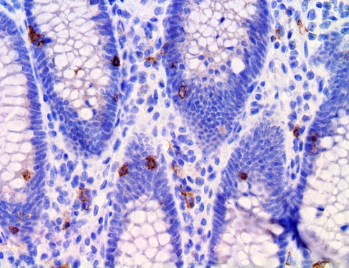 IHC of CD103 on an FFPE Colon Tissue